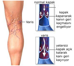 varis nedir nasil olusur