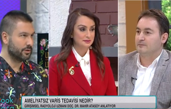 TV8 - Ameliyatsız Varis Tedavileri