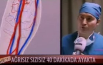 Kanal D - Ameliyatsız Varis Tedavisi